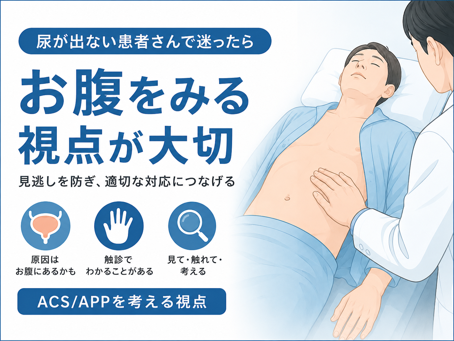 腹部コンパートメント症候群